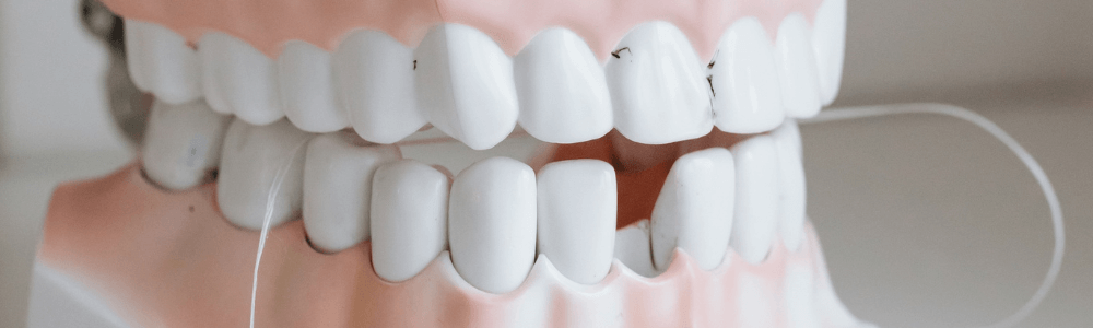 stained teeth model in Maidstone, Kent