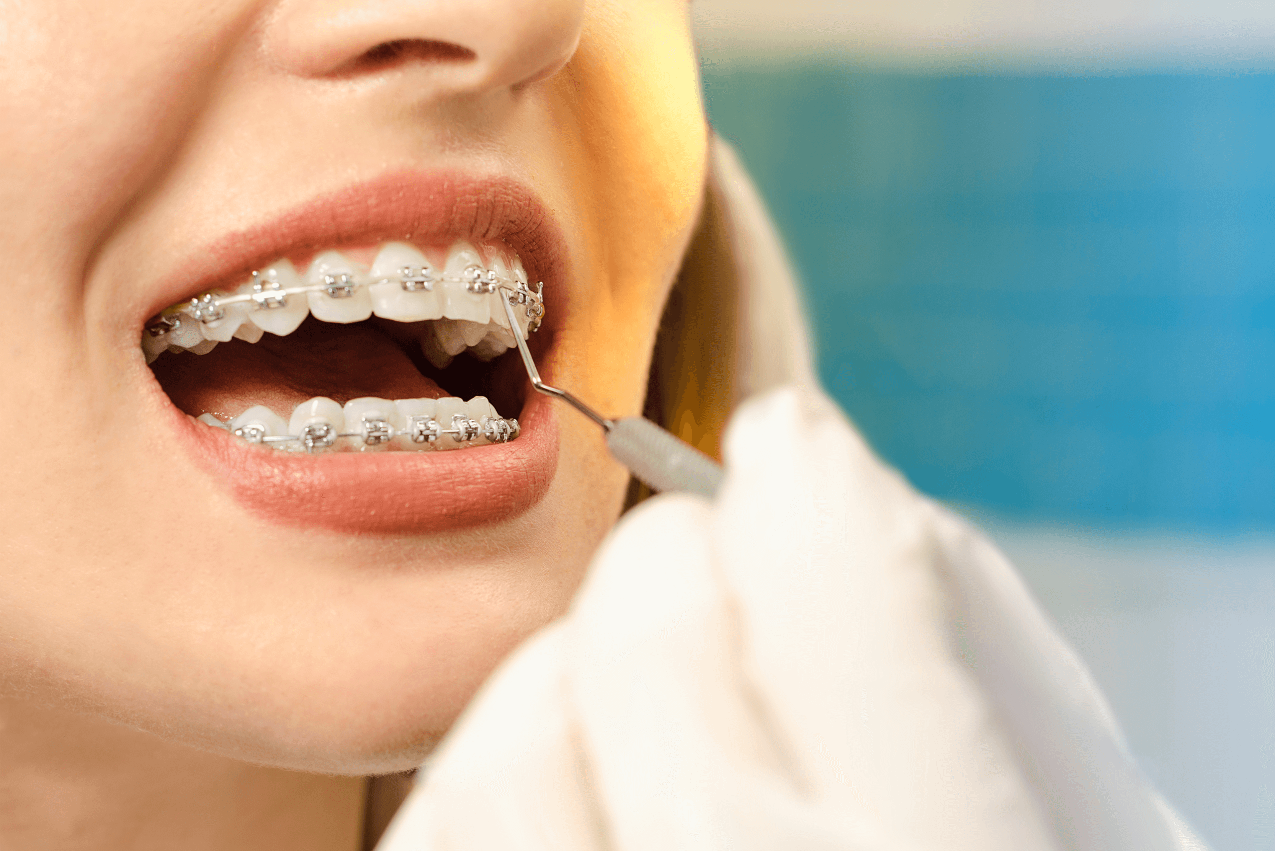 Can Braces Change Your Face Shape Roseacre Dental